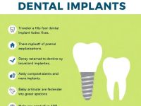 Benefits of Dental Implants