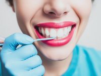 Common Myths About Teeth Whitening Debunked