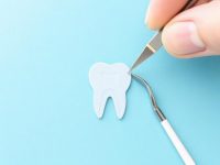 What to Do If You Chip a Tooth